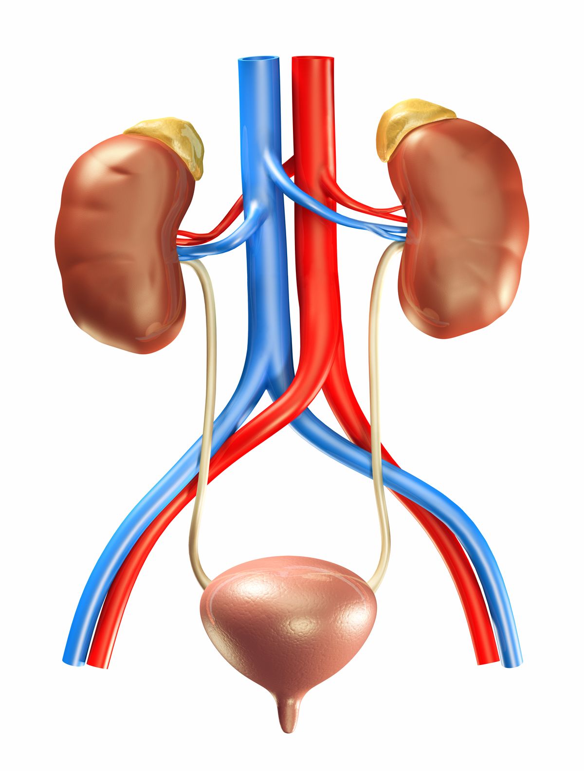 verstopfte Arterien